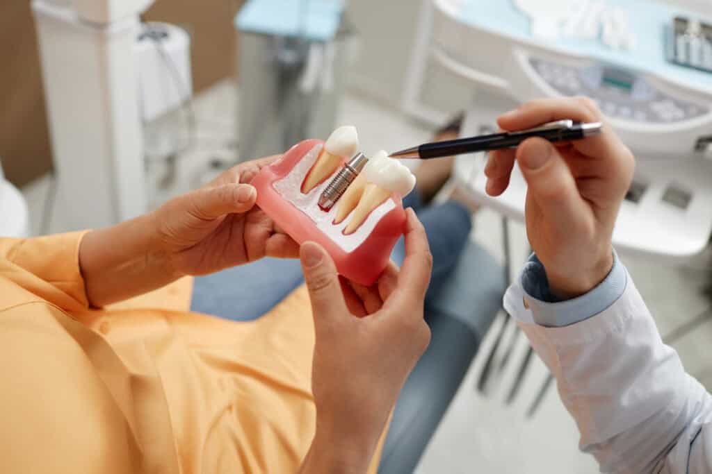 Restoring a dental implant with a custom crown to complete a healthy smile.
