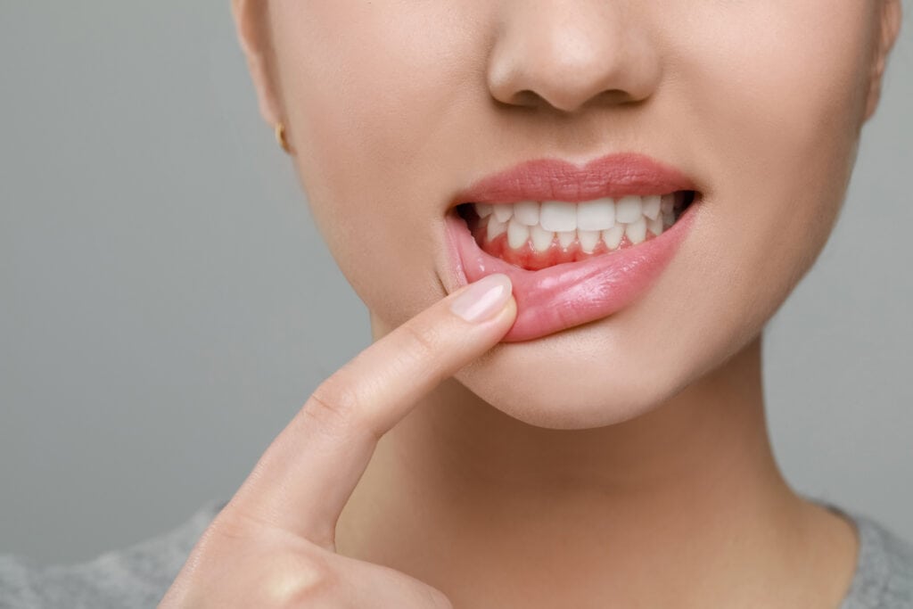 eriodontal maintenance and preventative gum disease treatment in Park City.